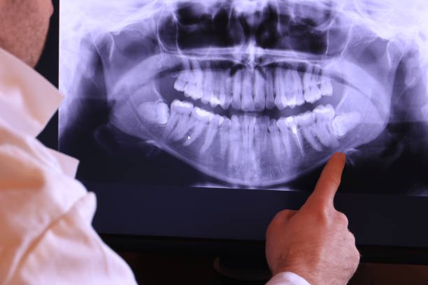 Best Emergency Treatment for Oral Infections in Dover Base Housing, DE