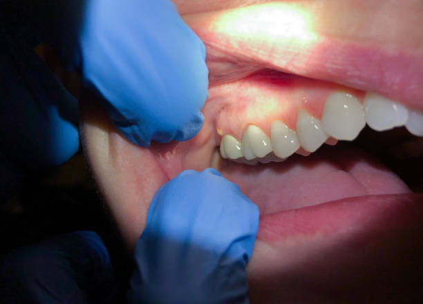 Best Emergency Dental Care for Sports Injuries in Dover Base Housing, DE