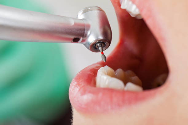 Best Emergency Treatment for Jaw Pain or Injury in Dover Base Housing, DE